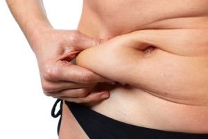 tummy tuck - Dr Drielsma expert body contouring surgeon