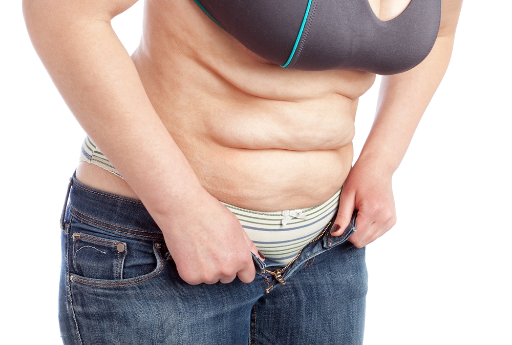 tummy tuck after weight loss