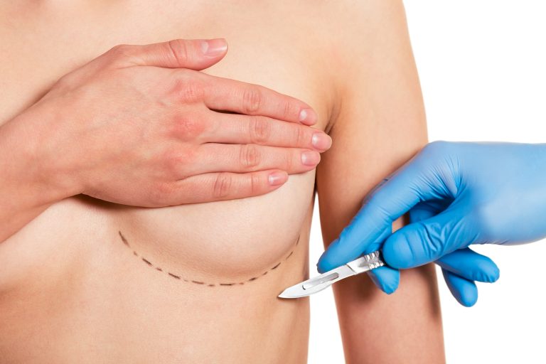 4 Top Types of Breast Lift Techniques